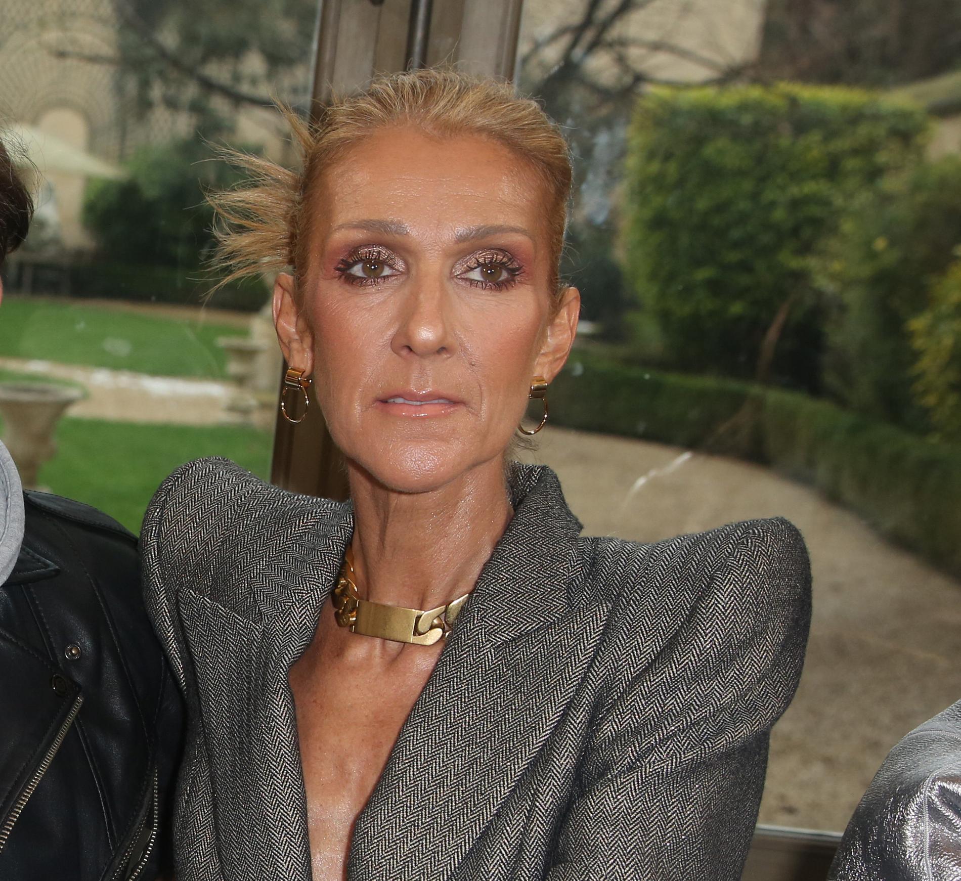 Celine Dion’s sister: – She has no control over her muscles