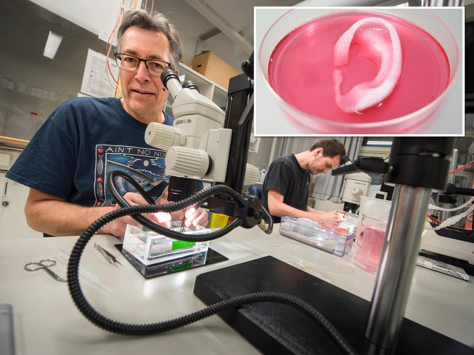 Intakt Dejlig lettelse 400 nordmenn i organkø: Kan 3D-printing av organer redde liv? - VG